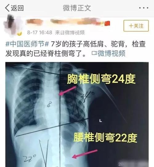 电脑坐姿错误及其原因（如何改正错误的电脑坐姿）-第3张图片-数科之翼