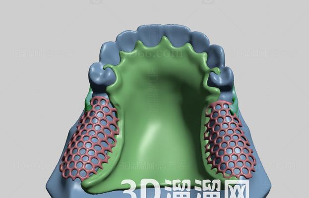 义齿活动支架电脑设计教程（提升义齿适应性与舒适度的关键技术）-第1张图片-数科之翼